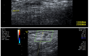Case 1 figure 2 illustration